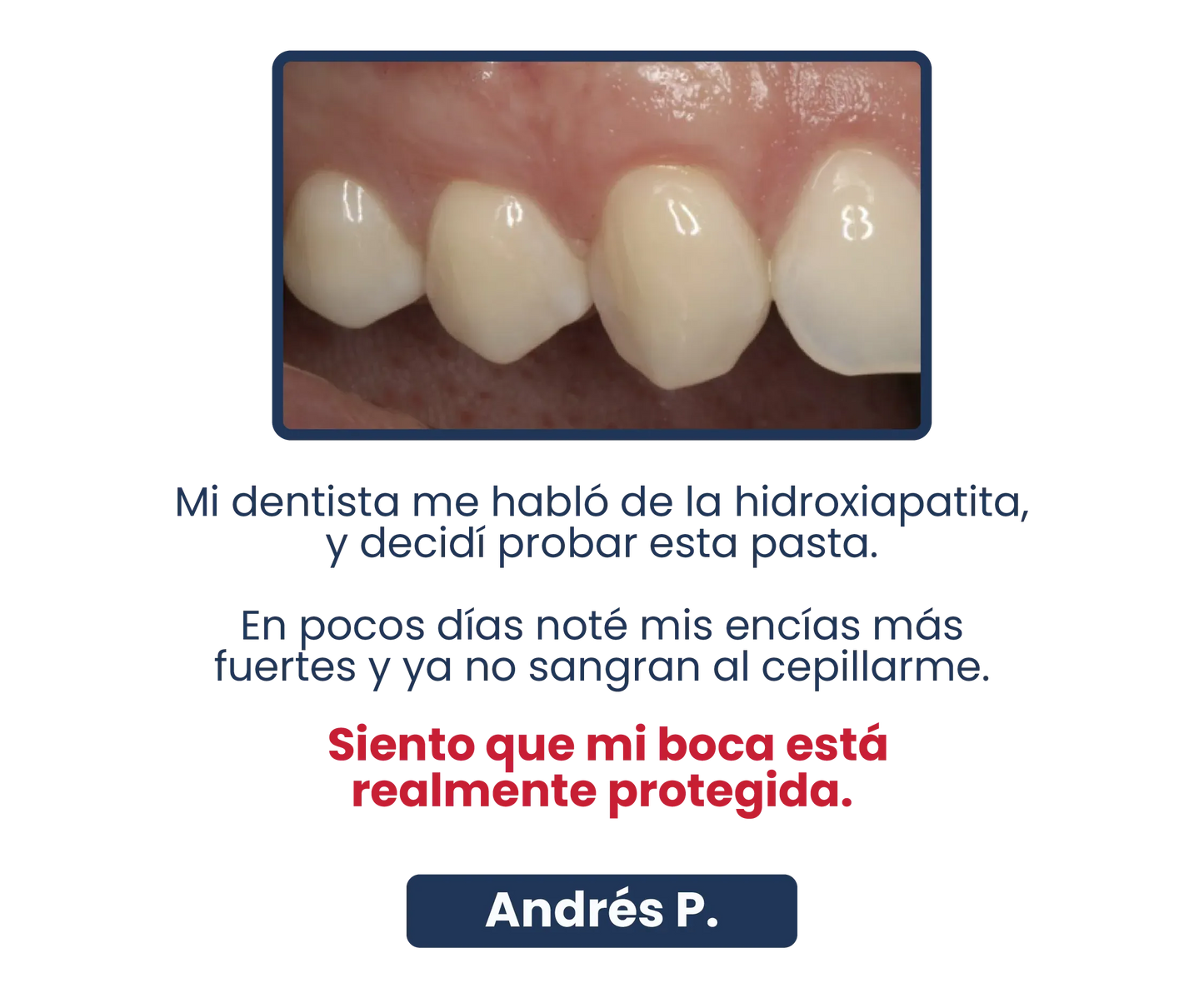 SP-6 Pasta de Dientes Blanqueadora Probiótica