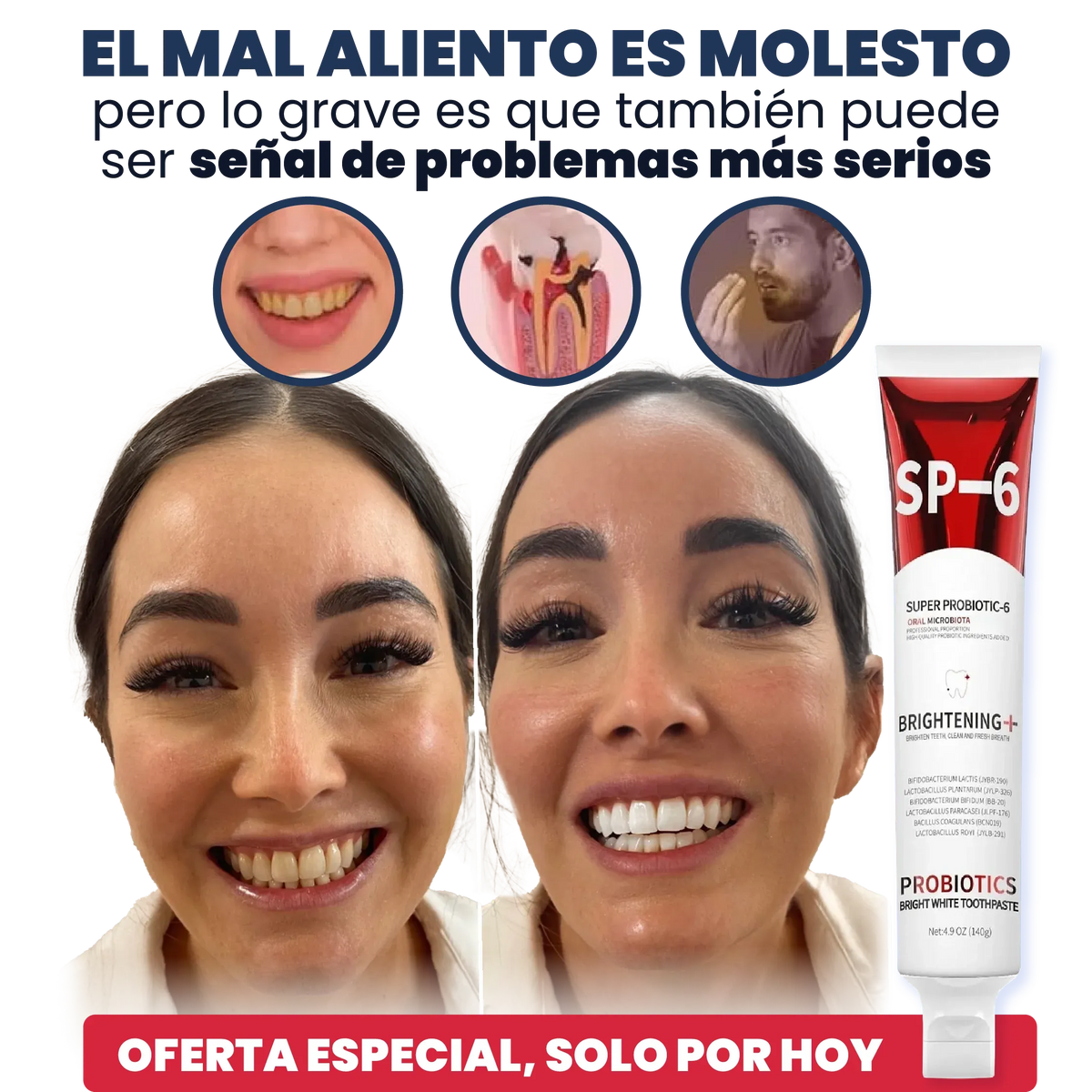 SP-6 Pasta de Dientes Blanqueadora Probiótica