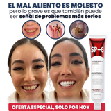 SP-6 Pasta de Dientes Blanqueadora Probiótica