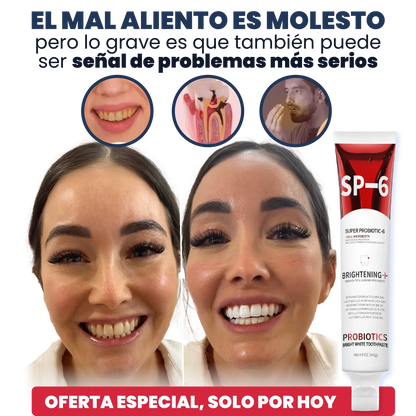 SP-6 Pasta de Dientes Blanqueadora Probiótica
