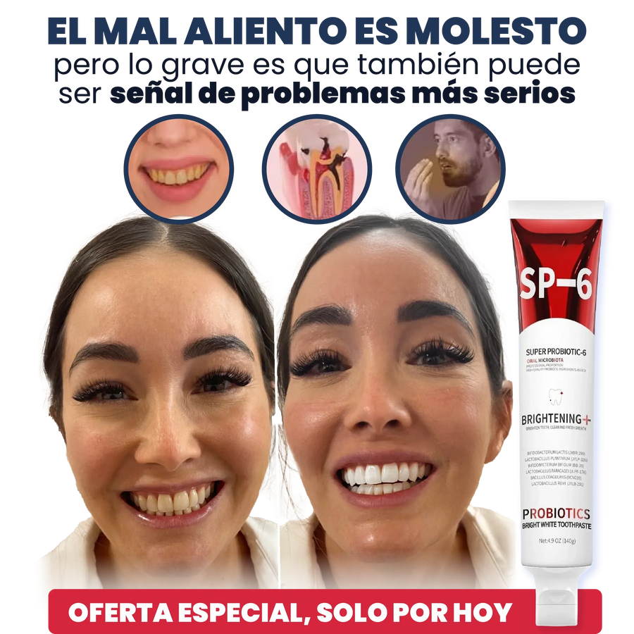 SP-6 Pasta de Dientes Blanqueadora Probiótica