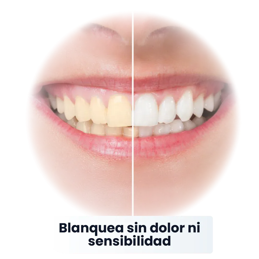 SP-6 Pasta de Dientes Blanqueadora Probiótica