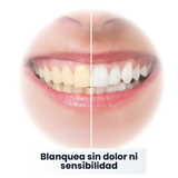 SP-6 Pasta de Dientes Blanqueadora Probiótica