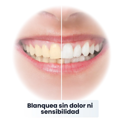 SP-6 Pasta de Dientes Blanqueadora Probiótica