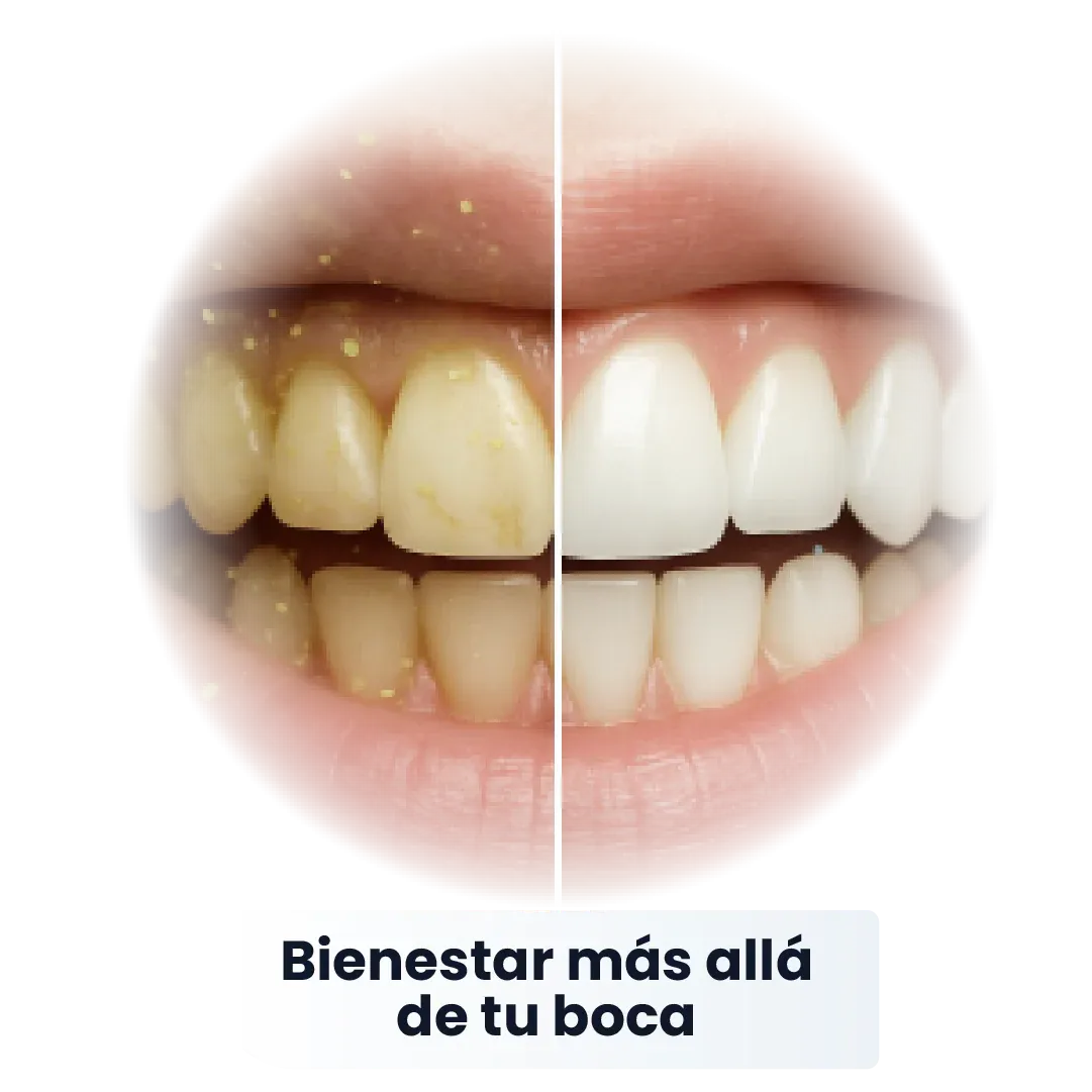 SP-6 Pasta de Dientes Blanqueadora Probiótica