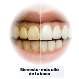 SP-6 Pasta de Dientes Blanqueadora Probiótica
